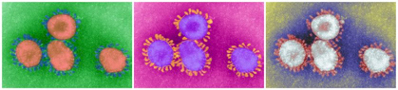 Coronaviruses visible under an electron microscope, coloured - Credits: BSIP/UIG - Getty